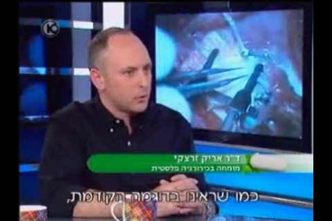 מיקרוכירורגיה - ערוץ 10